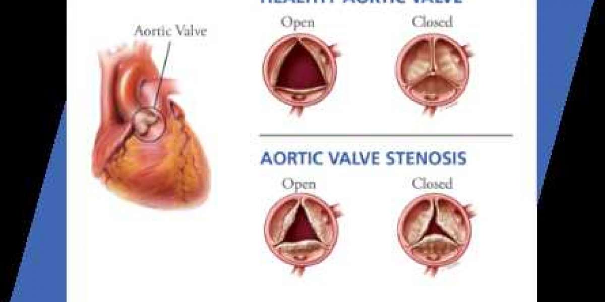 Heart Disease treatment near torrance