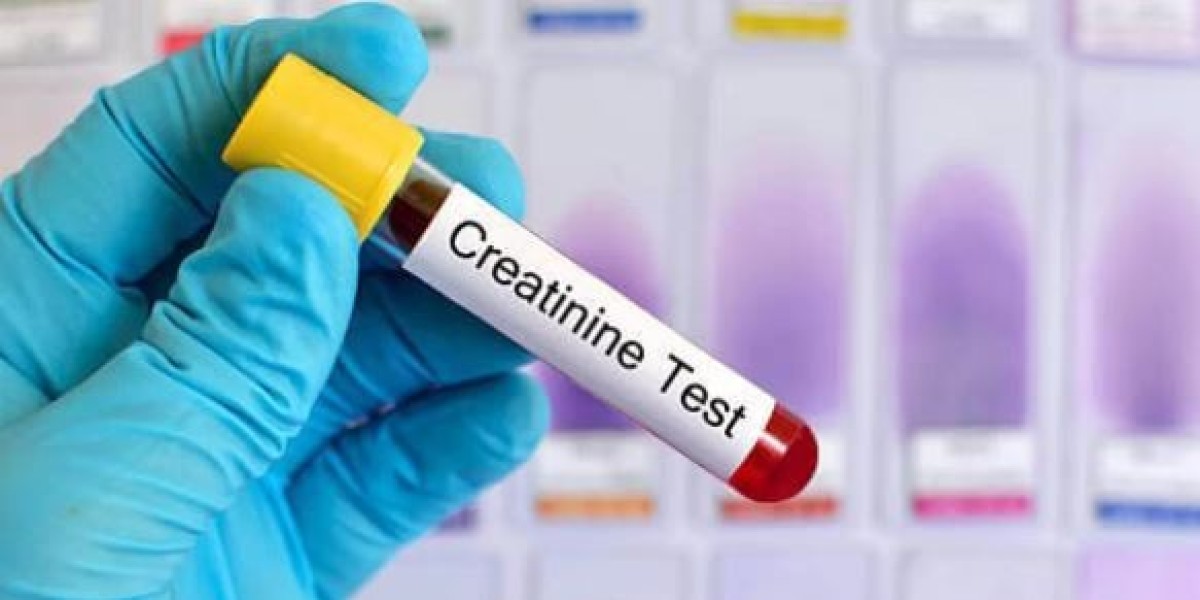 Know All About Creatinine Test Cost in Mumbai