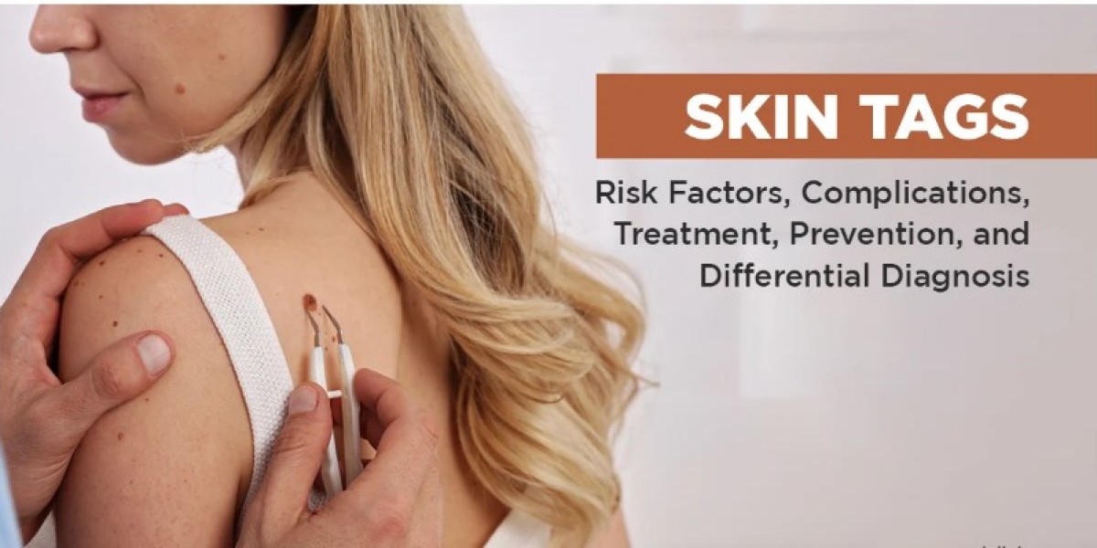 Skinbiotix MD Reviews {Warnings}: Side Effects, Does It Work?