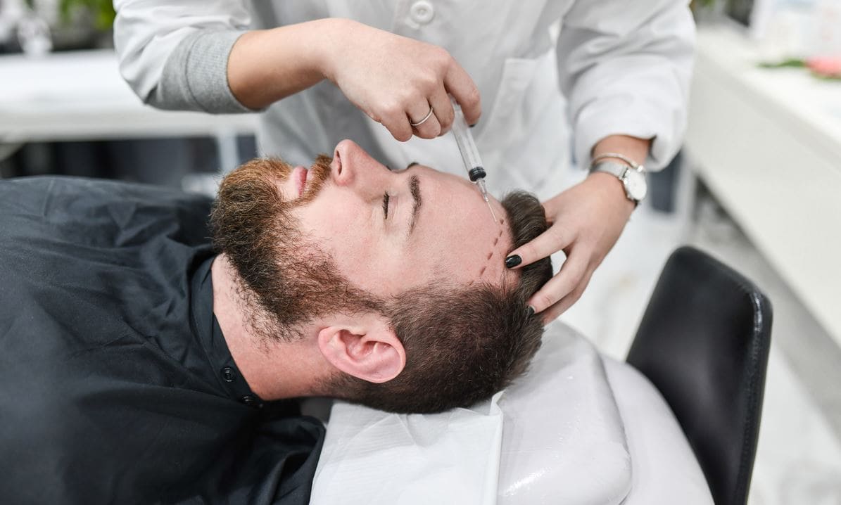 Hair Transplants & Local Anesthesia: What's the Correlation? - Scoopify