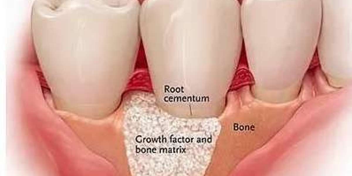 Tooth Regeneration Market Size, Analysis 2023–2030