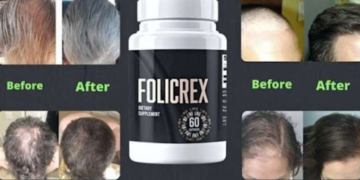 [Updated 2024] Folicrex Hair Regrowth Supplement Discounted News!! {Official news}