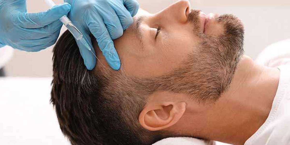 Can You Get A Hair Transplant On Your Crown?