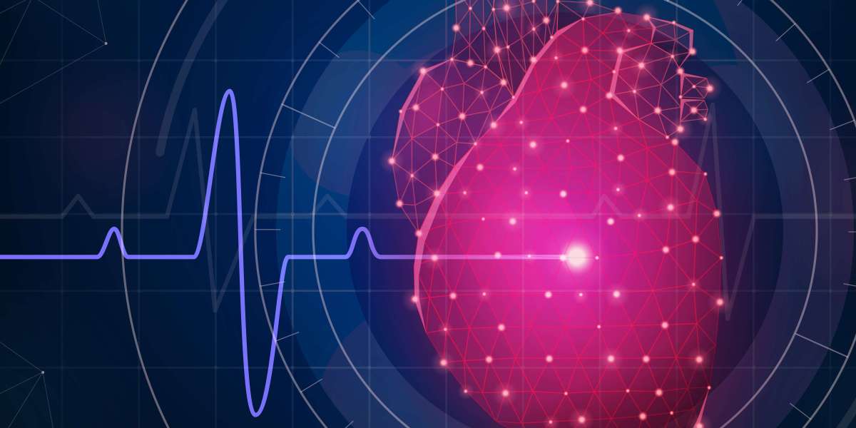 Decoding the Interventional Cardiology Devices Market: Key Trends & Outlook