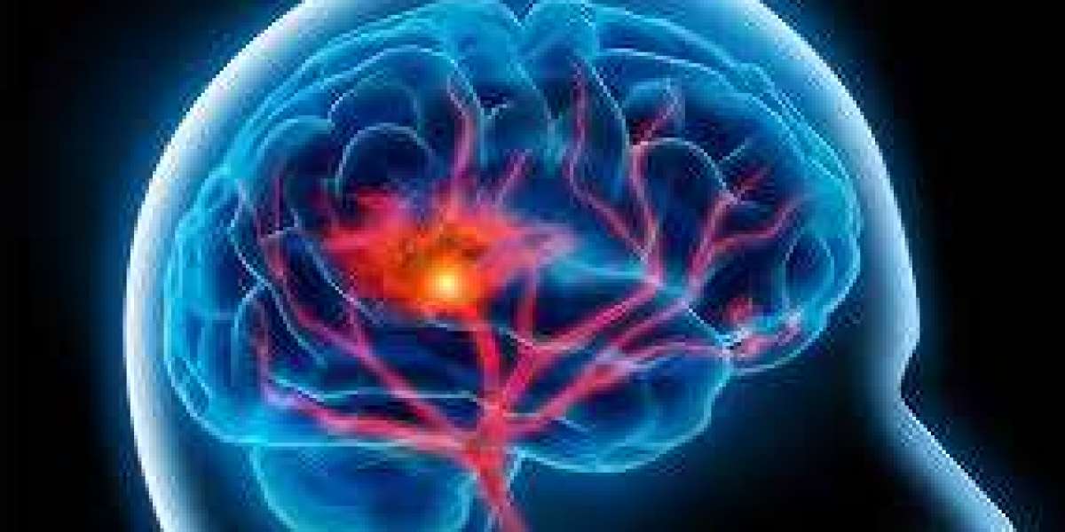 What Is Perfect Method To Take Neuro Brain?