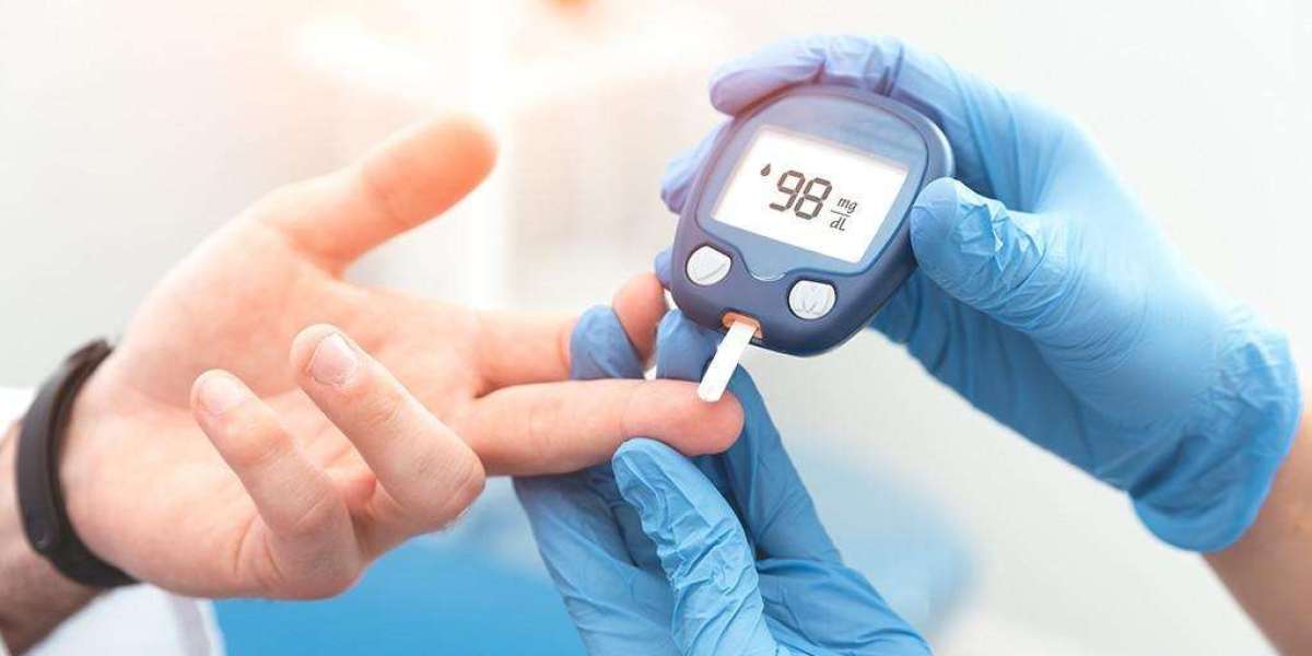 CircuLife Blood Pressure USA Price - Hoax Or Legit [Reviews 2024]?