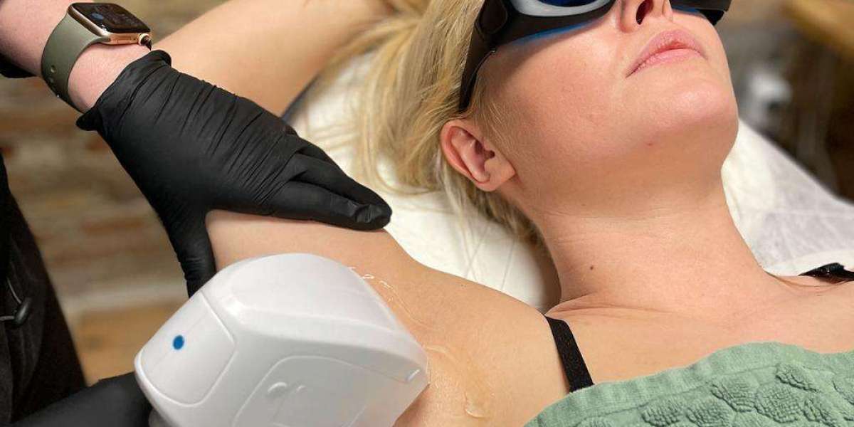 A Guide to Laser Treatments in Kristiansand: All You Need to Know