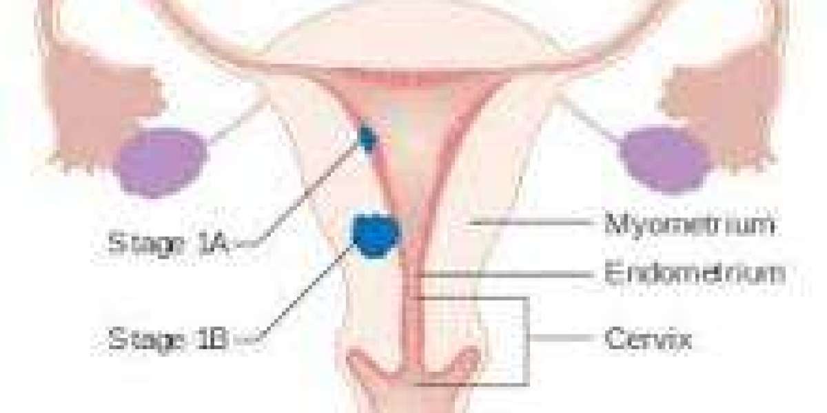 Endometrial Cancer Awareness: Signs, Prevention, and Care