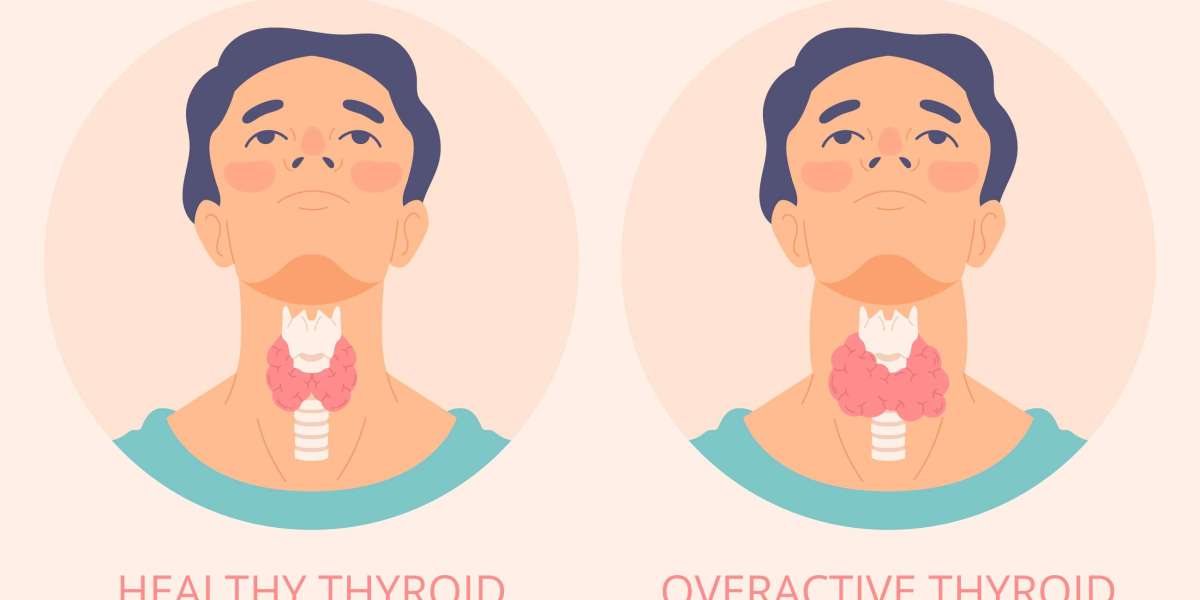 How Stress Affects Your Thyroid and What You Can Do About It